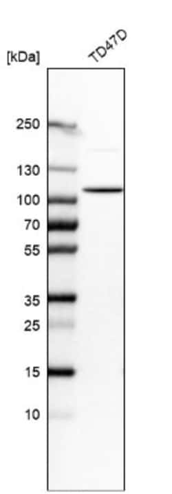 DHTKD1 Antibody, Novus Biologicals:Antibodies:Primary Antibodies